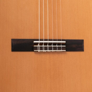 Angel Lopez Alicante Cm