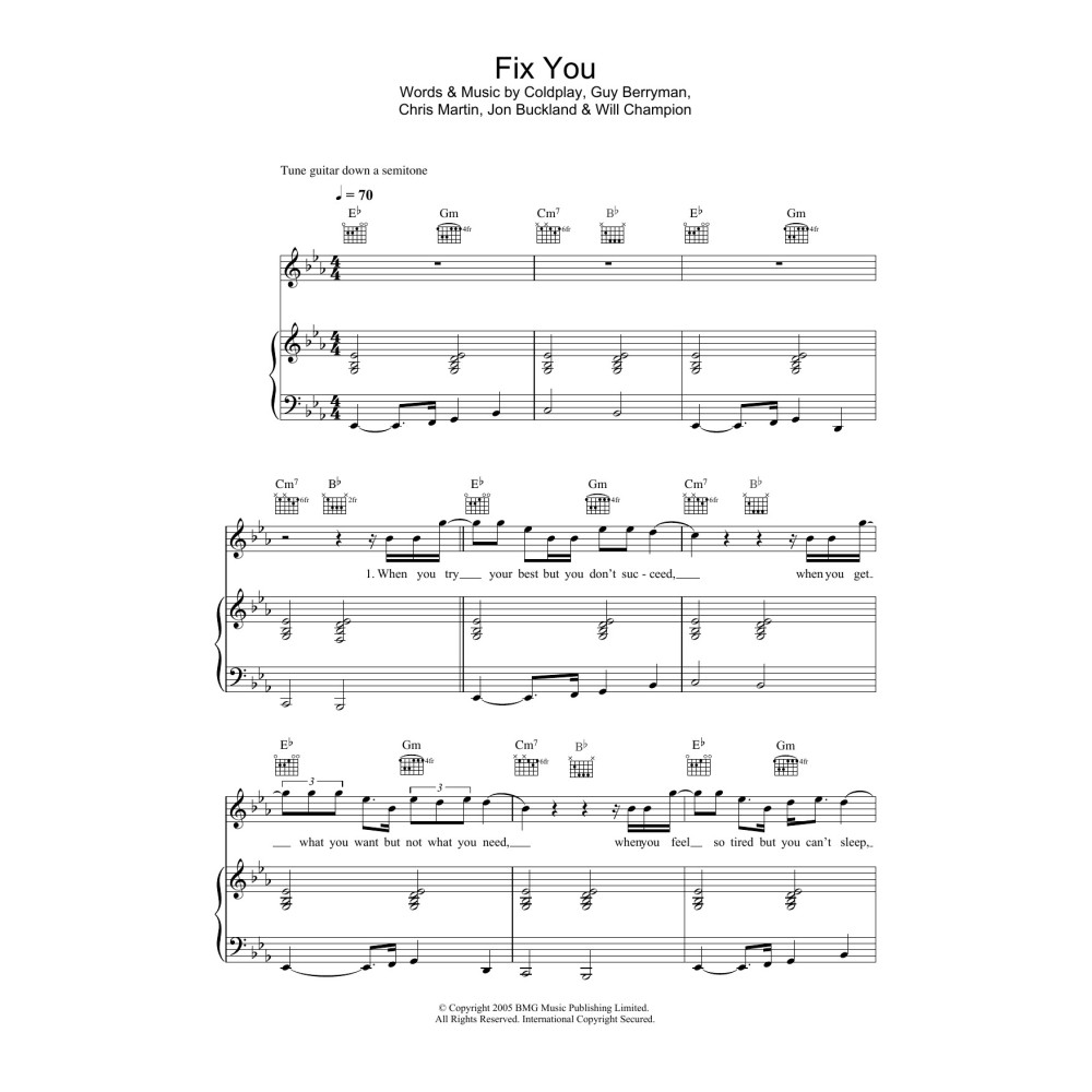 Fix You
