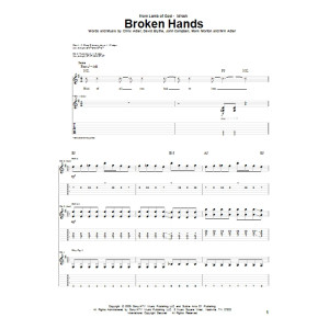 Broken Hands