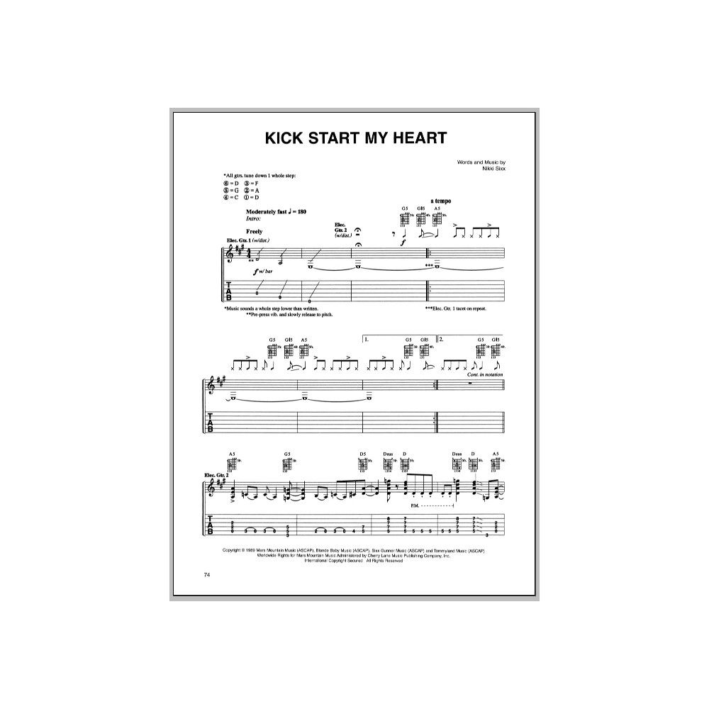 Kick Start My Heart