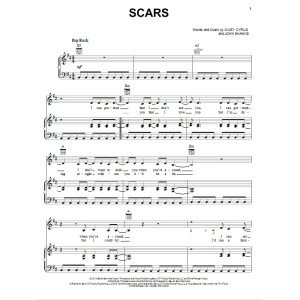 Scars